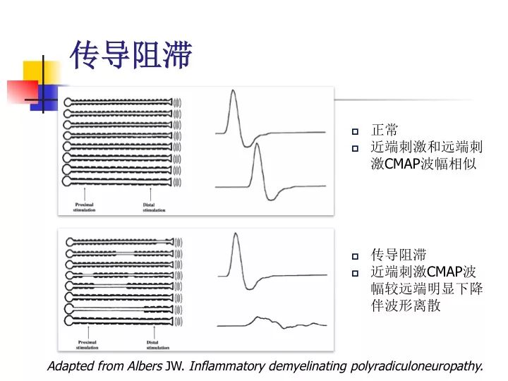 管道测径，理解与应用